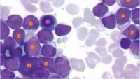 Морфология клеток костного мозга Vision Hema® Bone Marrow